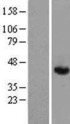 Western Blot Aldolase A Overexpression Lysate