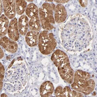 Immunohistochemistry-Paraffin: Aldolase B Antibody [NBP1-87494] - Staining of human kidney shows moderate cytoplasmic positivity in cells in proximal tubules.