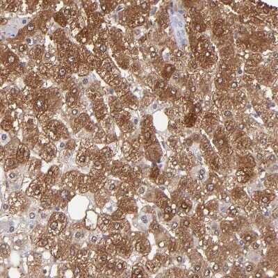 Immunohistochemistry-Paraffin: Aldolase B Antibody [NBP1-87494] - Staining of human liver shows moderate to strong cytoplasmic positivity in hepatocytes.