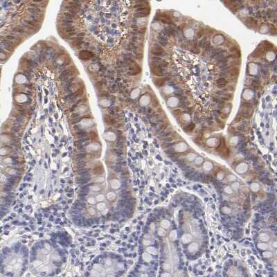 Immunohistochemistry-Paraffin: Aldolase B Antibody [NBP1-87494] - Staining of human small intestine shows moderate cytoplasmic positivity in glandular cells.