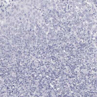 Immunohistochemistry-Paraffin: Aldolase B Antibody [NBP1-87494] - Staining of human tonsil shows no positivity in lymphoid cells as expected.