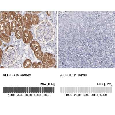 <b>Orthogonal Strategies Validation. </b>Immunohistochemistry-Paraffin: Aldolase B Antibody [NBP1-87494] - Staining in human kidney and tonsil tissues . Corresponding ALDOB RNA-seq data are presented for the same tissues.