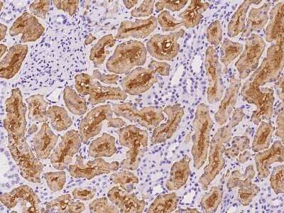 Immunohistochemistry-Paraffin: Aldolase B Antibody [NBP2-97910] - Immunochemical staining of human Aldolase B in human kidney with rabbit polyclonal antibody at 1:100 dilution, formalin-fixed paraffin embedded sections.