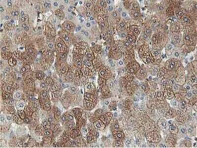 Immunohistochemistry: Aldolase B Antibody (OTI3C6) - Azide and BSA Free [NBP2-70162] - Staining of paraffin-embedded Human liver tissue using anti-Aldolase B mouse monoclonal antibody.