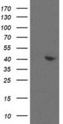 Western Blot: Aldolase B Antibody (OTI3C6) - Azide and BSA Free [NBP2-70162] - HEK293T cells were transfected with the pCMV6-ENTRY control (Left lane) or pCMV6-ENTRY Aldolase B (Right lane) cDNA for 48 hrs and lysed. Equivalent amounts of cell lysates (5 ug per lane) were separated by SDS-PAGE and immunoblotted with anti-Aldolase B.