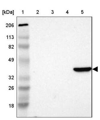 Western Blot: Aldolase B Antibody [NBP1-87494] - Lane 1: Marker  [kDa] 206, 113, 82, 49, 32, 26, 18.   Lane 2: Human cell line RT-4.  Lane 3: Human cell line U-251MG sp.  Lane 4: Human cell line A-431 Lane 5: Human liver tissue