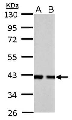 Western Blot: Aldolase B Antibody [NBP2-15345] - A.  30 ug PC-12 whole cell lysate/extract, B. 30 ug Rat 2 whole cell lysate/extract 10% SDS-PAGE gel, antibody dilution 1:1000.