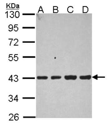 Western Blot: Aldolase B Antibody [NBP2-15345] - Sample (30 ug of whole cell lysate) A: 293T B: A431 C: JurKat D: Raji 10% SDS PAGE; antibody diluted at 1:1000.