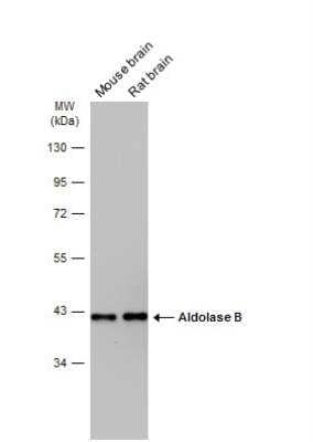 Western Blot: Aldolase B Antibody [NBP2-15345] - Various tissue extracts (50 ug) were separated by 10% SDS-PAGE, and the membrane was blotted with Aldolase B antibody diluted at 1:5000. The HRP-conjugated anti-rabbit IgG antibody (NBP2-19301) was used to detect the primary antibody.