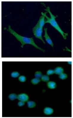 Immunocytochemistry/Immunofluorescence: Aldolase C Antibody (2E11) [NBP2-59408] - Analysis of ALDOC in U87MG cells line, stained with DAPI (Blue) for nucleus staining and monoclonal anti-human   ALDOC antibody (1:100) with goat anti-mouse IgG-Alexa fluor 488 conjugate (Green). Analysis of ALDOC in Jurkat cells line, stained with DAPI (Blue) for nucleus staining and monoclonal anti-human   ALDOC antibody (1:100) with goat anti-mouse IgG-Alexa fluor 488 conjugate (Green).