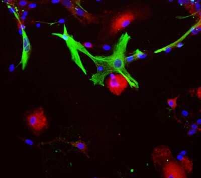 Immunocytochemistry/Immunofluorescence: Aldolase C Antibody (E9) [NBP2-50056] - View of mixed neuron/glial cultures stained with NBP2-50056 (red) and chicken antibody to GFAP (NBP1-05198, green). NBP2-50056 reveals strong cytoplasmic staining in astrocytes. Blue is a DNA stain. Aldolase stains the astrocytes cell body and processes, whereas GFAP labels the intermediate filament of the cytoskeleton in subset of astrocytes.