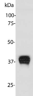 Western Blot: Aldolase C Antibody (E9) [NBP2-50056] - Right: Blots of rat brain lysate blotted with NBP2-50056. NBP2-50056 binds strongly and cleanly to a band at about 40 kDa. This antibody binds to an epitope shared by the closely related Aldolase A, B and C, recognizing all three on western blots.  Above: Blots of recombinant human Aldolase A, B and C with NBP2-50056 as indicated showing binding to all three gene products. Lane labelled S show molecular weight standards, while lanes A, B and C contain recombinant full length His-tagged human Aldolase A, B and C respectively. The epitope for NBP2-50056 is within the core of the three Aldolase molecules which are less conserved than the N and C-termini where Aldolase C specific antibodies bind. The specificity of two other Aldolase antibodies is shown in the indicated parts of the image. One antibody binds to the N-terminal peptide (clone 4A9) and one to the C-terminal peptide (clone 1A1).