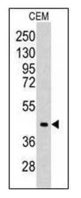 Western Blot: Aldolase C Antibody [NBP1-50546] - CEM cell line lysates (35ug/lane).
