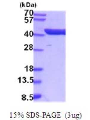 SDS-Page: Aldolase C Recombinant Protein [NBP2-52078] - 15% SDS Page (3 ug)