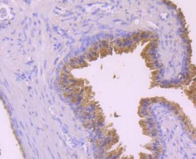 Immunohistochemistry-Paraffin: Alix Antibody (JM85-31) [NBP2-75403] - Analysis of paraffin-embedded human prostate tissue using anti-ALIX antibody. Counter stained with hematoxylin.