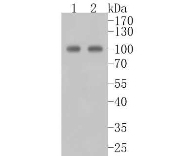 Western Blot: Alix Antibody (JM85-31) [NBP2-75403] - Western blot analysis of Alix on different lysates. Proteins were transferred to a PVDF membrane and blocked with 5% BSA in PBS for 1 hour at room temperature. The primary antibody (1/500) was used in 5% BSA at room temperature for 2 hours. Goat Anti-Rabbit IgG - HRP Secondary Antibody (HA1001) at 1:5,000 dilution was used for 1 hour at room temperature. Positive control: Lane 1: Hela cell lysate Lane 2: SH-SY5Y cell lysate