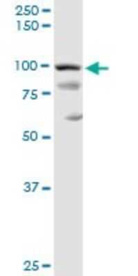 Western Blot: Alix Antibody [H00010015-D01P] - Analysis of PDCD6IP expression in HeLa.