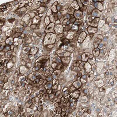 Immunohistochemistry-Paraffin: Alkaline Phosphatase, Tissue Non-Specific Antibody [NBP1-91659] - Staining of human adrenal gland shows strong membranous positivity in glandular cells.