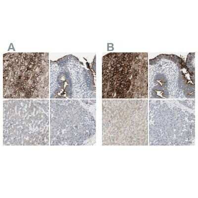 Immunohistochemistry-Paraffin: Alkaline Phosphatase, Tissue Non-Specific Antibody [NBP1-91659] - Staining of human adrenal gland, endometrium, liver and pancreas using Anti-Alkaline Phosphatase, Tissue Non-Specific antibody NBP1-91659 (A) shows similar protein distribution across tissues to independent antibody NBP1-91660 (B).