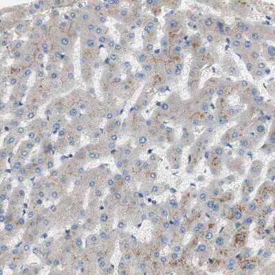 Immunohistochemistry-Paraffin: Alkaline Phosphatase, Tissue Non-Specific Antibody [NBP1-91659] - Staining of human liver shows weak membranous positivity in hepatocytes.