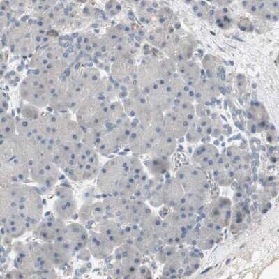 <b>Independent Antibodies Validation. </b>Immunohistochemistry-Paraffin: Alkaline Phosphatase, Tissue Non-Specific Antibody [NBP1-91659] - Staining of human pancreas shows no positivity in glandular cells as expected.