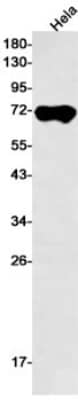 Western Blot: Alkaline Phosphatase/ALPP Antibody (S01-8I3) [NBP3-20050] - Western blot detection of Alkaline Phosphatase/ALPP in Hela cell lysates using NBP3-20050 (1:500 diluted). Predicted band size: 58kDa. Observed band size: 70kDa.