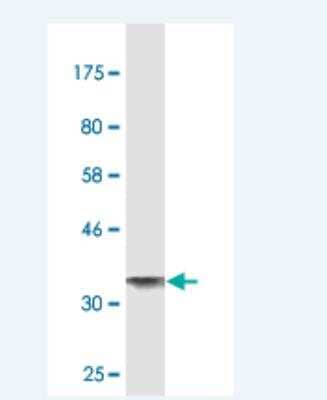Western Blot: Alkaline Phosphatase, Tissue Non-Specific Antibody (3A7) [H00000249-M02] - Detection against Immunogen (37.73 KDa) .