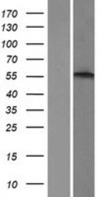 Western Blot: alpha-1B Adrenergic R/ADRA1B Overexpression Lysate [NBP2-10695] - Left-Empty vector transfected control cell lysate (HEK293 cell lysate); Right -Over-expression Lysate for Alpha 1b Adrenergic Receptor.