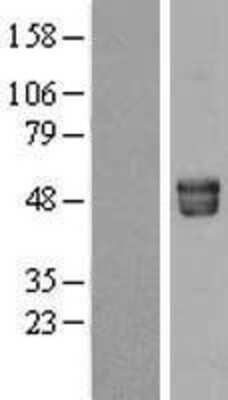 Western Blot Fetuin A/AHSG Overexpression Lysate