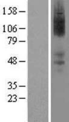 Western Blot: alpha-2A Adrenergic R/ADRA2A Overexpression Lysate [NBL1-07357] - Left-Empty vector transfected control cell lysate (HEK293 cell lysate); Right -Over-expression Lysate for Alpha 2a Adrenergic Receptor.