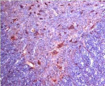 Immunohistochemistry: alpha-2C Adrenergic R/ADRA2C Antibody [NB110-39031] - Staining  in rat ventral spinal cord. Detection was done using HRP-AEC staining reagents (red color), and tissues were counterstained with hematoxylin (blue color).  Working dilution is 1:100-1:300