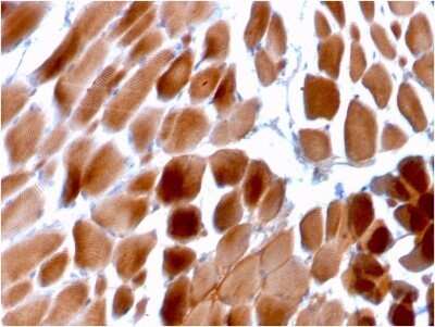 Immunohistochemistry-Paraffin: Alpha Actinin 2 Antibody (ACTN2/3292) - Azide and BSA Free [NBP2-79838] - Formalin-fixed, paraffin-embedded human Cardiac Muscle stained with Alpha Actinin 2 Antibody (ACTN2/3292).