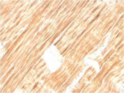 Immunohistochemistry-Paraffin: Alpha Actinin 2 Antibody (ACTN2/3292) - Azide and BSA Free [NBP2-79838] - Formalin-fixed, paraffin-embedded human Skeletal Muscle stained with Alpha Actinin 2 Antibody (ACTN2/3292).