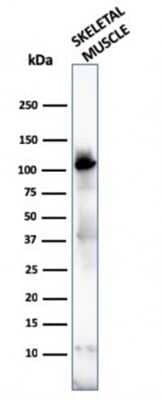 Western Blot: Alpha Actinin 2 Antibody (ACTN2/3292) - Azide and BSA Free [NBP2-79838] - Western Blot of human skeletal muscle tissue lysates using Alpha Actinin 2 Antibody (ACTN2/3292).