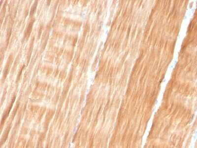 Immunohistochemistry-Paraffin: Alpha Actinin 2 Antibody (ACTN2/3293) - Azide and BSA Free [NBP2-79839] - Formalin-fixed, paraffin-embedded human Skeletal Muscle stained with Alpha Actinin 2 Antibody (ACTN2/3293).