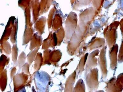 Immunohistochemistry-Paraffin: Alpha Actinin 2 Antibody (ACTN2/3293) - Azide and BSA Free [NBP2-79839] - Formalin-fixed, paraffin-embedded human cardiac muscle stained with Alpha Actinin 2 Antibody (ACTN2/3293).