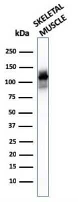 Western Blot: Alpha Actinin 2 Antibody (ACTN2/3293) - Azide and BSA Free [NBP2-79839] - Western Blot of human skeletal muscle tissue lysates using Alpha Actinin 2 Antibody (ACTN2/3293).