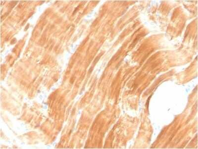 Immunohistochemistry-Paraffin: Alpha Actinin 2 Antibody (ACTN2/3294) [NBP3-08787] - Formalin-fixed, paraffin-embedded human skeletal muscle stained with Alpha Actinin 2 Mouse Monoclonal Antibody (ACTN2/3294).