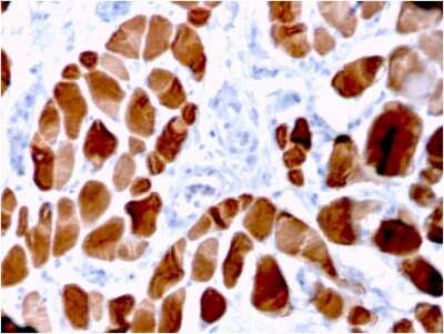 Immunohistochemistry-Paraffin: Alpha Actinin 2 Antibody (ACTN2/3294) [NBP3-08787] - Formalin-fixed, paraffin-embedded human skeletal muscle stained with Alpha Actinin 2 Mouse Monoclonal Antibody (ACTN2/3294).