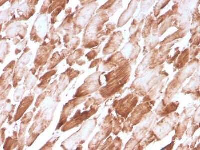 Immunohistochemistry-Paraffin: Alpha Actinin 2 Antibody (ACTN2/3294) [NBP3-08787] - Formalin-fixed, paraffin-embedded human cardiac muscle stained with Alpha Actinin 2 Mouse Monoclonal Antibody (ACTN2/3294).