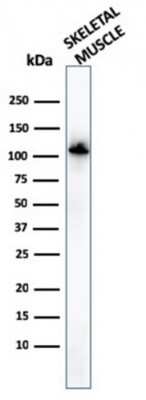 Western Blot: Alpha Actinin 2 Antibody (ACTN2/3294) [NBP3-08787] - Western Blot of human skeletal muscle tissue lysates using Alpha Actinin 2 Mouse Monoclonal Antibody (ACTN2/3294).