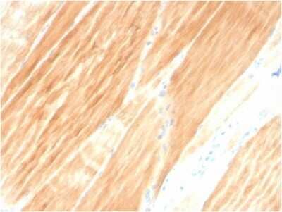 Immunohistochemistry-Paraffin: Alpha Actinin 2 Antibody (ACTN2/3295) - Azide and BSA Free [NBP3-08788] - Formalin-fixed, paraffin-embedded human Skeletal Muscle stained with Alpha Actinin 2 Mouse Monoclonal Antibody (ACTN2/3295).