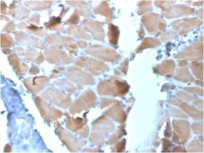 Immunohistochemistry-Paraffin: Alpha Actinin 2 Antibody (ACTN2/3295) - Azide and BSA Free [NBP3-08788] - Formalin-fixed, paraffin-embedded human Cardiac Muscle stained with Alpha Actinin 2 Mouse Monoclonal Antibody (ACTN2/3295).