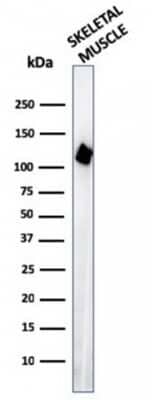 Western Blot: Alpha Actinin 2 Antibody (ACTN2/3295) - Azide and BSA Free [NBP3-08788] - Western Blot of human Skeletal muscle tissue lysates using Alpha Actinin 2 Mouse Monoclonal Antibody (ACTN2/3295).