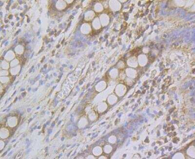 Immunohistochemistry: Alpha Actinin 2 Antibody (JE45-22) [NBP2-76889] - Immunohistochemical analysis of paraffin-embedded human colon tissue using anti-Sarcomeric Alpha Actinin antibody. The section was pre-treated using heat mediated antigen retrieval with Tris-EDTA buffer (pH 8.0-8.4) for 20 minutes. The tissues were blocked in 5% BSA for 30 minutes at room temperature, washed with ddH2O and PBS, and then probed with the antibody at 1/200 dilution, for 30 minutes at room temperature and detected using an HRP conjugated compact polymer system. DAB was used as the chrogen. Counter stained with hematoxylin and mounted with DPX.