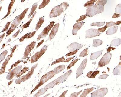 Immunohistochemistry-Paraffin: Alpha Actinin 2 Antibody (JE45-22) [NBP2-76889] - Analysis of paraffin-embedded mouse smooth muscle tissue with Rabbit anti-Sarcomeric Alpha Actinin antibody washed with ddH2O and PBS, and then probed with the primary antibody  at 1/100 dilution for 1 hour at room temperature. The detection was performed using an HRP conjugated compact polymer system. DAB was used as the chromogen. Tissues were counterstained with hematoxylin and mounted with DPX.