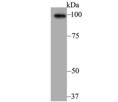 Western Blot: Alpha Actinin 2 Antibody (JE45-22) [NBP2-76889] - Western blot analysis of Sarcomeric Alpha Actinin on mouse heart tissue lysate. Proteins were transferred to a PVDF membrane and blocked with 5% BSA in PBS for 1 hour at room temperature. The primary antibody was used at a 1:500 dilution in 5% BSA at room temperature for 2 hours. Goat Anti-Rabbit IgG - HRP Secondary Antibody at 1:5,000 dilution was used for 1 hour at room temperature.