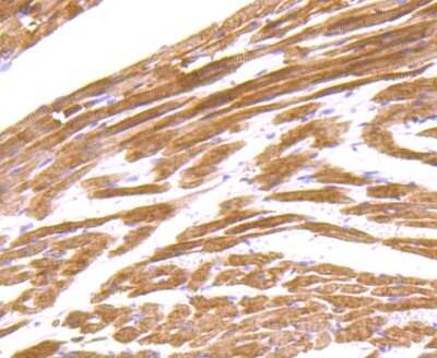 Immunohistochemistry-Paraffin: Alpha Actinin 2 Antibody (JF0980) [NBP2-67143] - Analysis of paraffin-embedded mouse heart tissue using anti-ACTN2 antibody. Counter stained with hematoxylin.