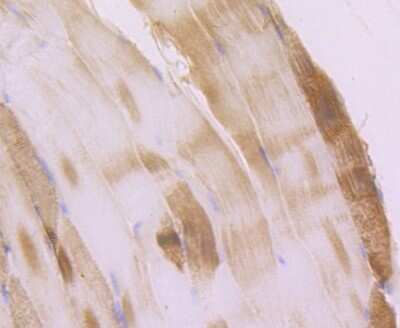 Immunohistochemistry-Paraffin: Alpha Actinin 2 Antibody (JF0980) [NBP2-67143] - Analysis of paraffin-embedded mouse skeletal tissue using anti-ACTN2 antibody. Counter stained with hematoxylin.