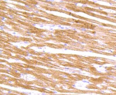 Immunohistochemistry-Paraffin: Alpha Actinin 2 Antibody (JF0980) [NBP2-67143] - Analysis of paraffin-embedded rat heart tissue using anti-ACTN2 antibody. Counter stained with hematoxylin.